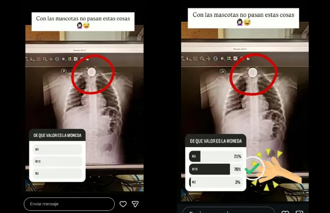 Foto sobre Una niña de 7 años se tragó una moneda y una funcionaria habría utilizado su radiografía para burlarse en Instagram